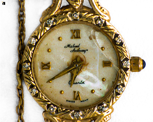Before #41 Michael Anthony Chain Watch Prior To Professional Restoration Services